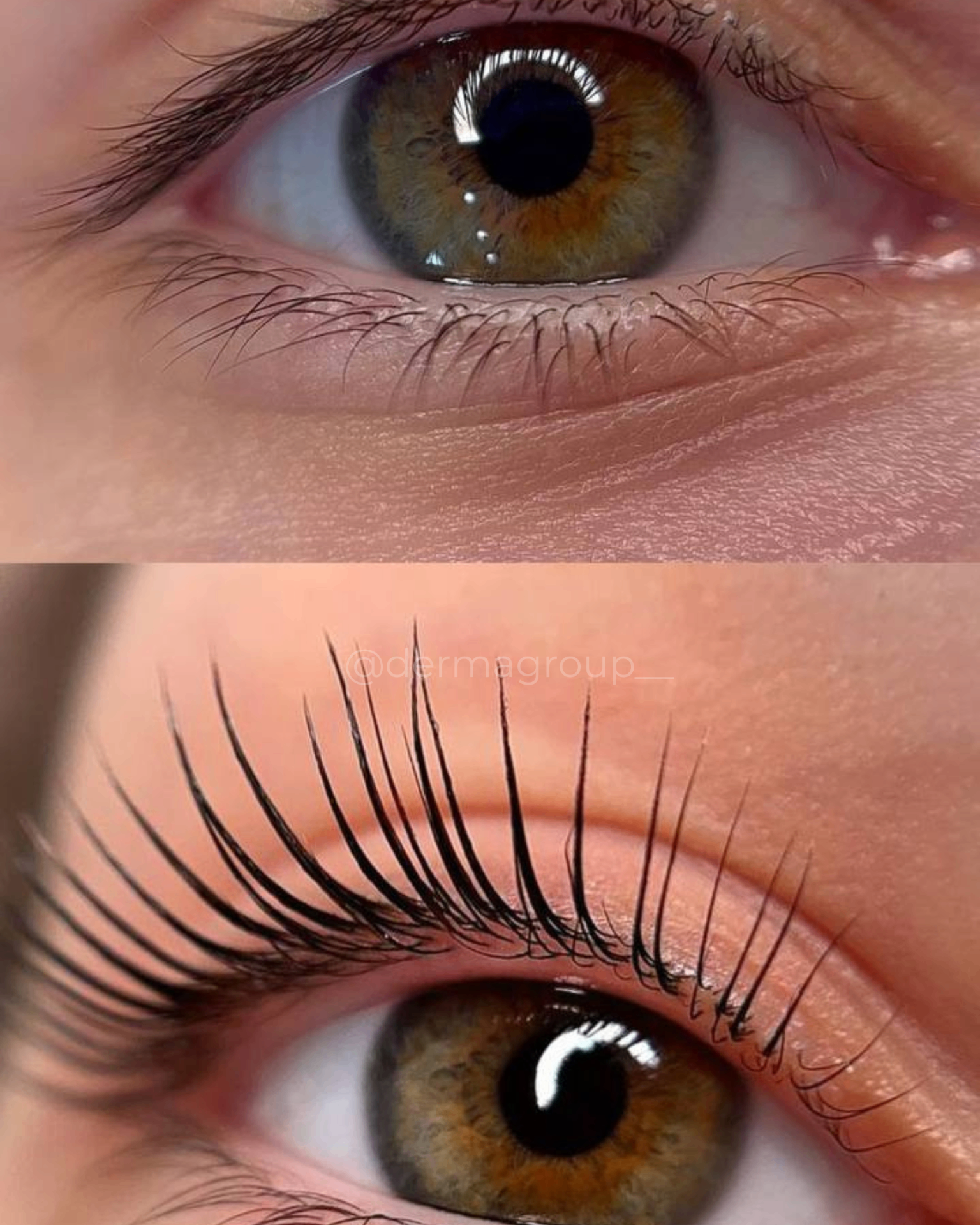 Lash Lifting - Antes y después real